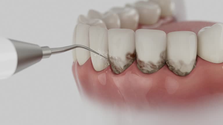 Reliable Wisdom Tooth Removal contractor in Madison County County, NC by Dentist Open Now